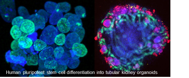 pluripotent stem cell