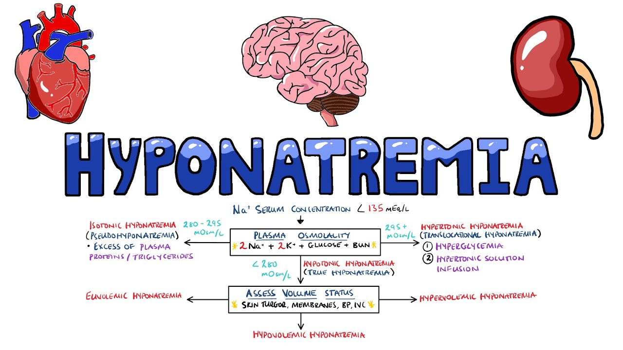 Hyponatremia