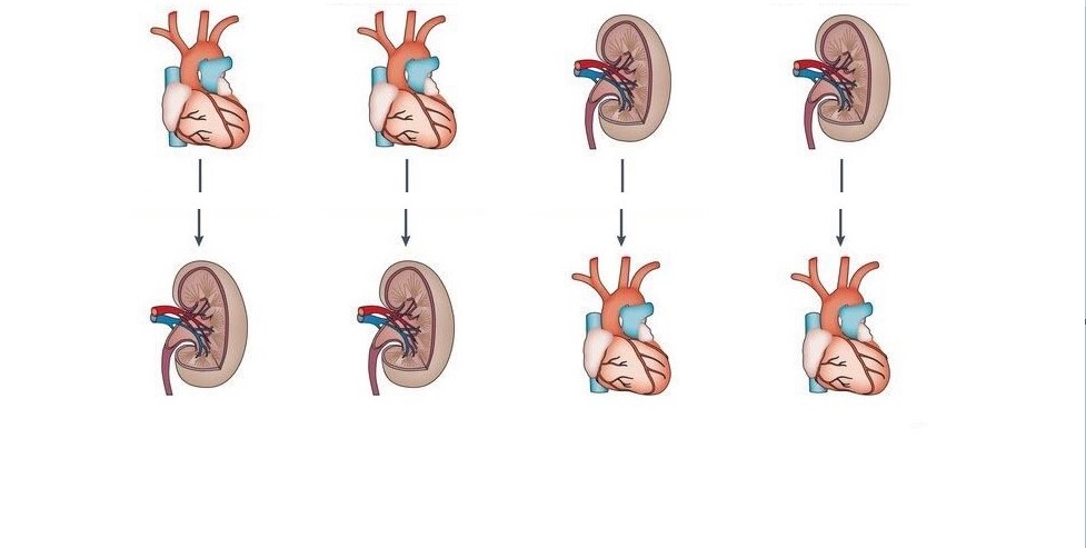 Cardiorenal
