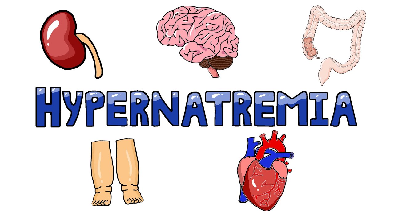 Hypernatremia
