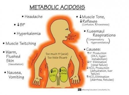 Metabolic Acidosis