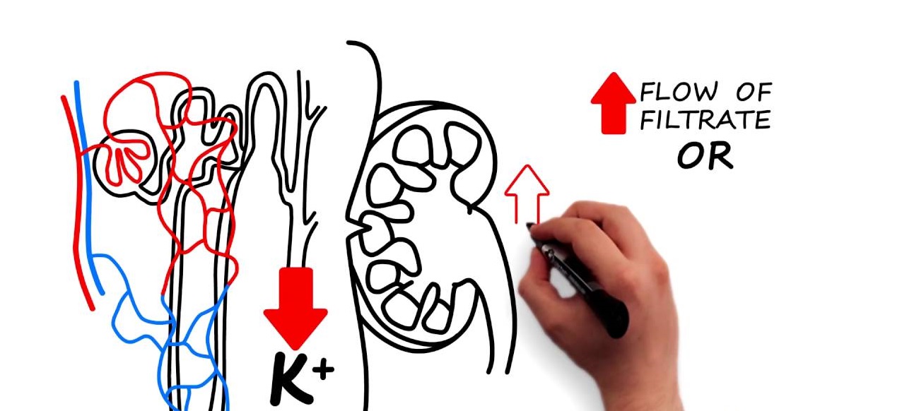 Hypokalemia