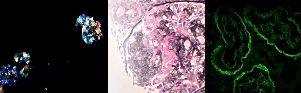 Biopsy Conf slide images