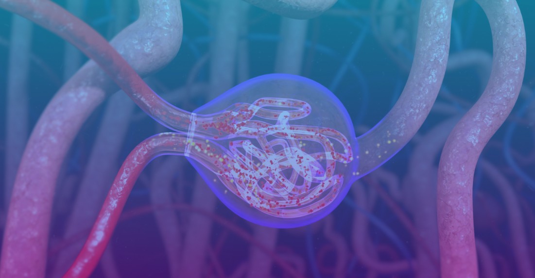 Glomerular Disease image