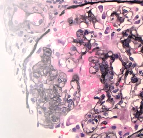 Biopsy Conf image